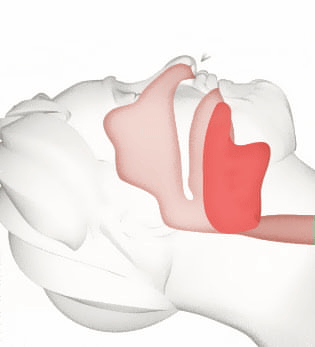 The image is a 3D rendering of a human head in a sleeping position showing how the airway moves during sleep.